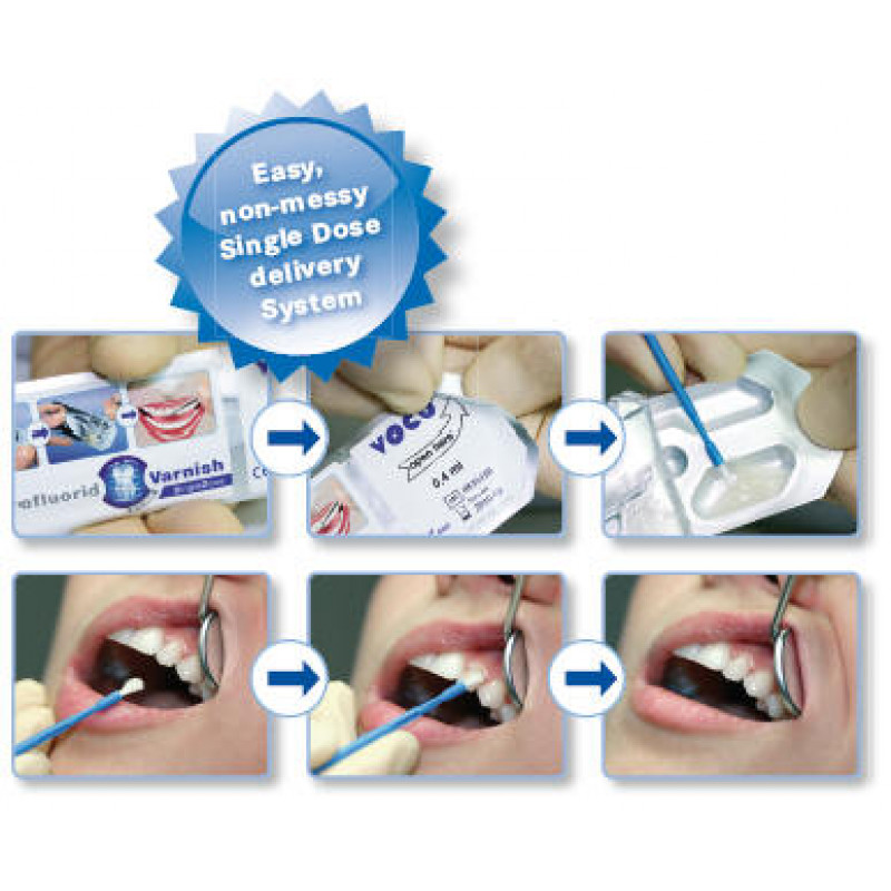 PROFLUORID VARNISH SINGLEDOSE X50